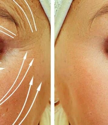 Ce soin botox like promet de lisser les rides en une minute : la nouveauté à découvrir