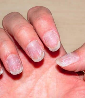 Ongles cassants : le secret pour les renforcer durablement sans les fragiliser