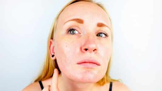 Ton teint devient gras pendant l'été ? Retire ces 4 soins de beauté