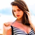 « Un vrai traumatisme » : ce que révèle votre peau qui pèle après un coup de soleil