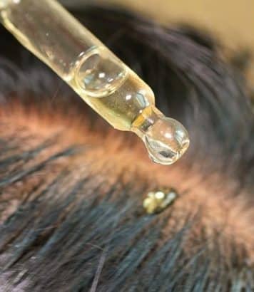 Ces sérums capillaires coréens que les dermatologues recommandent pour la pousse